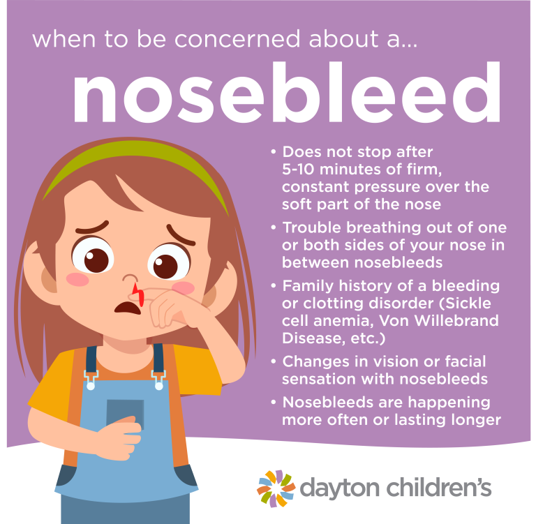 When To Be Concerned About A Nosebleed Dayton Children S Hospital   WhenToBeConcerned NoseBleed EP12437 (2) 